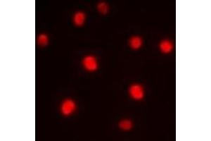 Immunofluorescent analysis of ZNF265 staining in HepG2 cells. (ZNF265 antibody)
