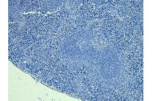 (ABIN185239) Negative Control showing staining of paraffin embedded Mouse Spleen, with no primary antibody.