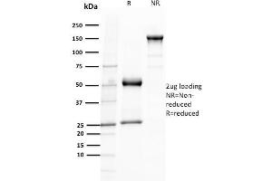 SDS-PAGE (SDS) image for anti-T-Cell Leukemia/lymphoma 1A (TCL1A) (AA 2-109) antibody (ABIN6940949)