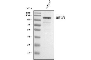 Western blot analysis of RHBDF2 using anti-RHBDF2 antibody (ABIN7600069).