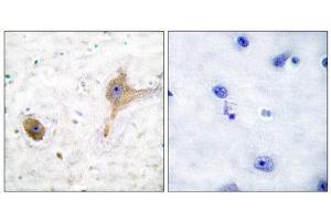 Immunohistochemistry (IHC) image for anti-GABA B Receptor (C-Term) antibody (ABIN1848554) (GABA B Receptor (C-Term) antibody)