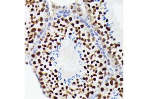 Immunohistochemistry of paraffin-embedded mouse testis using EWSR1 Rabbit mAb (ABIN7267053) at dilution of 1:100 (40x lens). (EWSR1 antibody)