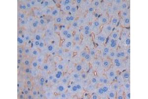 #VALUE! (CD84 antibody  (AA 32-222))
