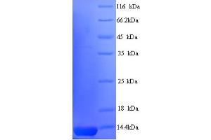 SDS-PAGE (SDS) image for ICP47 (AA 1-88), (full length) protein (His tag) (ABIN5714202) (ICP47 (AA 1-88), (full length) protein (His tag))