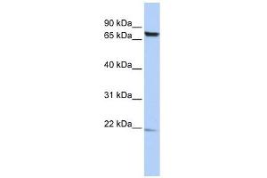 C7ORF38 antibody used at 1 ug/ml to detect target protein. (FAM200A antibody  (Middle Region))