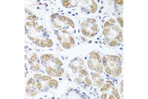 Immunohistochemistry of paraffin-embedded human stomach using ACP1 antibody (ABIN5975334) at dilution of 1/100 (40x lens).