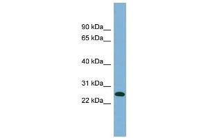 WB Suggested Anti-ITGB1BP3 Antibody Titration:  0. (ITGB1BP3 antibody  (Middle Region))