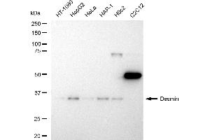 Western blotting analysis using Desmin antibody (ABIN7798314). (Recombinant Desmin antibody)