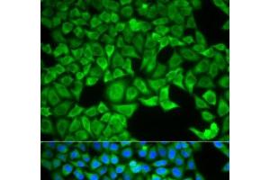 Immunofluorescence analysis of HeLa cells using SLC3A1 Polyclonal Antibody (SLC3A1 antibody)
