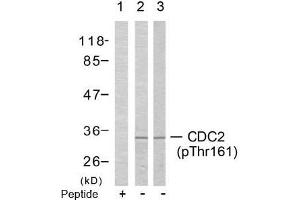Image no. 2 for anti-Cyclin-Dependent Kinase 1 (CDK1) (pThr161) antibody (ABIN196846) (CDK1 antibody  (pThr161))