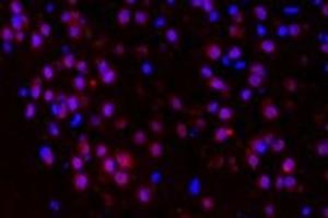Immunofluorescent analysis of paraformaldehyde-fixed mouse brain substantia nigra using p38IP (ABIN7075954) at dilution of 1: 400 (Transcription Factor SPT20 Homolog (SUPT20H) antibody)