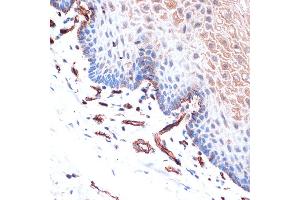 Immunohistochemistry of paraffin-embedded human esophageal using Cadherin-13 (CDH13) Rabbit mAb (ABIN7265996) at dilution of 1:100 (40x lens). (Cadherin 13 antibody)