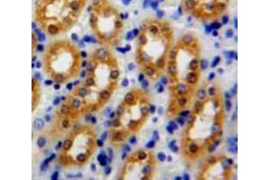 Used in DAB staining on fromalin fixed paraffin-embedded Kidney tissue (Peroxiredoxin 5 antibody  (AA 1-162))