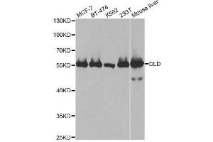 Western blot analysis of extracts of various cell lines, using DLD antibody. (DLD antibody  (AA 36-300))