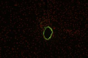 Immunohistochemistry staining (paraffin sections) of cytokeratin 19 in human liver using mouse monoclonal antibody BA-17 ((ABIN94288), diluted 1:100), detected with GAM IgG-Alexa Fluor488 (diluted 1:200, green), cell nuclei stained with PI (1 μg/mL, orange). (Cytokeratin 19 antibody)