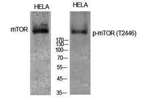 Western Blotting (WB) image for anti-Mechanistic Target of Rapamycin (serine/threonine Kinase) (mTOR) (pThr2446) antibody (ABIN3179552) (MTOR antibody  (pThr2446))
