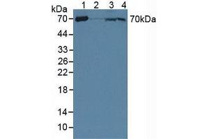 Figure. (CRAT antibody  (AA 1-430))