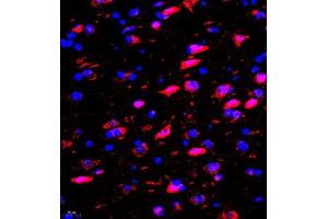 Immunofluorescence of paraffin embedded rat brain using rasgrf1 (ABIN7073422) at dilution of 1:2000 (400x lens) (Cdc25 antibody)