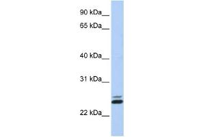 WB Suggested Anti-JAZF1 Antibody Titration:  0. (JAZF1 antibody  (N-Term))