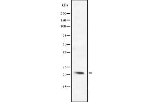 Western blot analysis of BCL2L10 expression in ; HepG2 cell lysate,The lane on the left is treated with the antigen-specific peptide. (BCL2L10 antibody  (Internal Region))