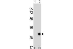 Western Blotting (WB) image for anti-Ethylmalonic Encephalopathy 1 (ETHE1) antibody (ABIN3002726) (ETHE1 antibody)