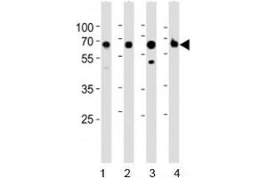 Western blot analysis of lysate from 1) human kidney, 2) mouse kidney, 3) mouse liver and 4) rat kidney tested with ACSM5 antibody at 1:1000. (ACSM5 antibody  (AA 562-596))