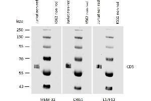 Western blotting analysis of human CD5 using mouse monoclonal antibodies MEM-32, CRIS1, and L17F12 on laurylmaltoside lysates of Jurkat cells and of K562 cells (negative control) under non-reducing conditions. (CD5 antibody)