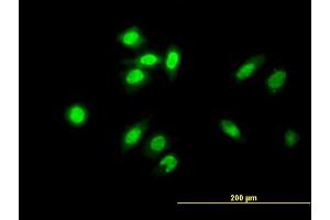 Immunofluorescence of monoclonal antibody to TESK2 on HeLa cell. (TESK2 antibody  (AA 405-542))