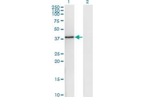 Western Blot analysis of DNAJB6 expression in transfected 293T cell line by DNAJB6 monoclonal antibody (M03), clone 1A5. (DNAJB6 antibody  (AA 72-172))
