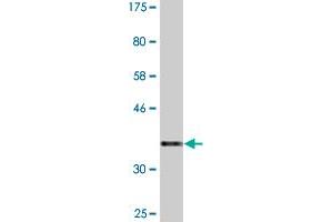 Western Blot detection against Immunogen (36. (PATZ1 antibody  (AA 260-358))