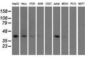 Western blot analysis of extracts (35 µg) from 9 different cell lines by using anti-HIBCH monoclonal antibody. (HIBCH antibody)