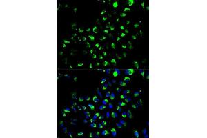 Immunofluorescence analysis of A549 cells using AK4 antibody.