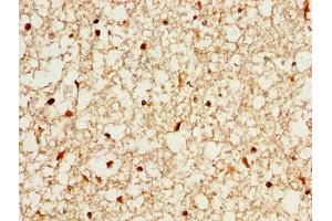 IHC image of ABIN7167550 diluted at 1:200 and staining in paraffin-embedded human brain tissue performed on a Leica BondTM system. (Reelin antibody  (AA 26-254))