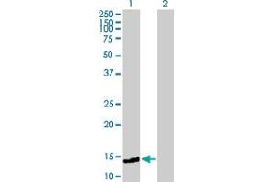 Western Blot analysis of FXC1 expression in transfected 293T cell line by FXC1 MaxPab polyclonal antibody. (TIMM10B antibody  (AA 1-103))