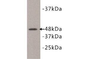 Western Blotting (WB) image for anti-Kinase D-Interacting Substrate, 220kDa (KIDINS220) antibody (ABIN1854930)
