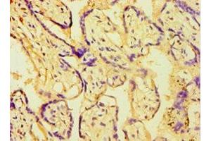 Immunohistochemistry of paraffin-embedded human placenta tissue using ABIN7145048 at dilution of 1:100 (ATPase Inhibitory Factor 1 antibody  (AA 26-106))