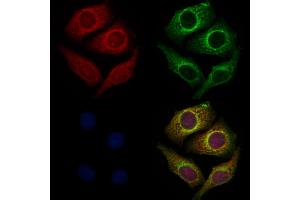 ABIN6261132 and ABIN6272283 staining Hela cells by IF/ICC. (CYB561D1 antibody  (C-Term))