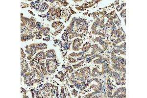 IHC analysis of ECE1 using anti-ECE1 antibody (ABIN5518828). (ECE1 antibody  (AA 18-233))