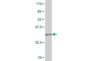 Western Blot detection against Immunogen (37. (CER1 antibody  (AA 158-266))