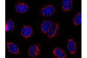 Immunofluorescence staining of HeLa cells using STIM1 monoclonal antibody, clone CDN3H4 . (STIM1 antibody  (C-Term))