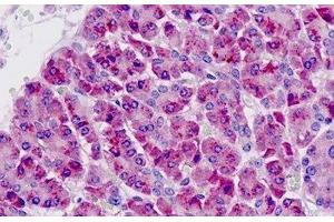 Human Pancreas: Formalin-Fixed, Paraffin-Embedded (FFPE) (PAK6 antibody  (AA 268-297))