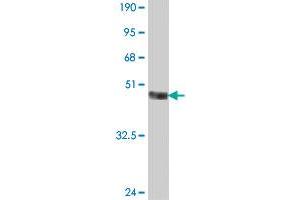Western Blotting (WB) image for anti-Ribosomal Protein S6 Kinase, 70kDa, Polypeptide 2 (RPS6KB2) (AA 1-100) antibody (ABIN562723)