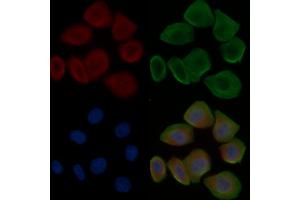 ABIN6265661 and ABIN6276530 staining Hela cells(30 min of UV treatment) by IF/ICC.