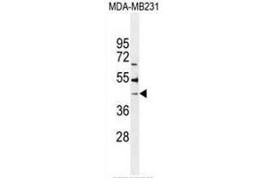 B4GALT6 antibody  (C-Term)