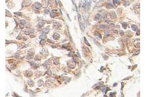 Immunohistochemical staining of formalin-fixed paraffin-embedded human fetal testis tissue showing nuclear staining with SCP2 polyclonal antibody  at 1 : 100 dilution. (SCP2 antibody  (AA 303-536))