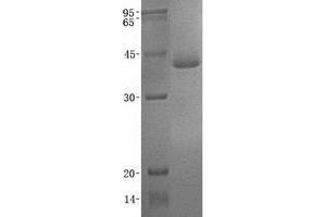 Western Blotting (WB) image for Acrosomal Vesicle Protein 1 (ACRV1) (Transcript Variant 1) protein (His tag) (ABIN2714344)