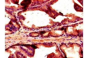 Immunohistochemistry of paraffin-embedded human prostate tissue using ABIN7161004 at dilution of 1:100 (NOX1 antibody  (AA 418-564))
