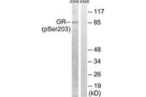 Western blot analysis of extracts from A549 cells treated with dexamethason 10nM 1h, using GR (Phospho-Ser203) Antibody. (GR (AA 171-220), (pSer203) antibody)