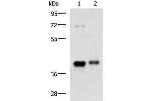 Western blot analysis of Mouse brain tissue and Human fetal brain tissue lysates using GNAZ Polyclonal Antibody at dilution of 1:1300 (GNaZ antibody)