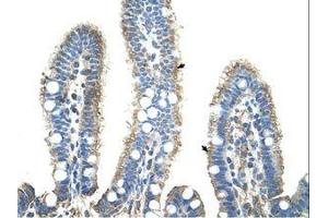 Image no. 1 for anti-Amyloid P Component, Serum (APCS) (AA 51-100) antibody (ABIN203493) (APCS antibody  (AA 51-100))